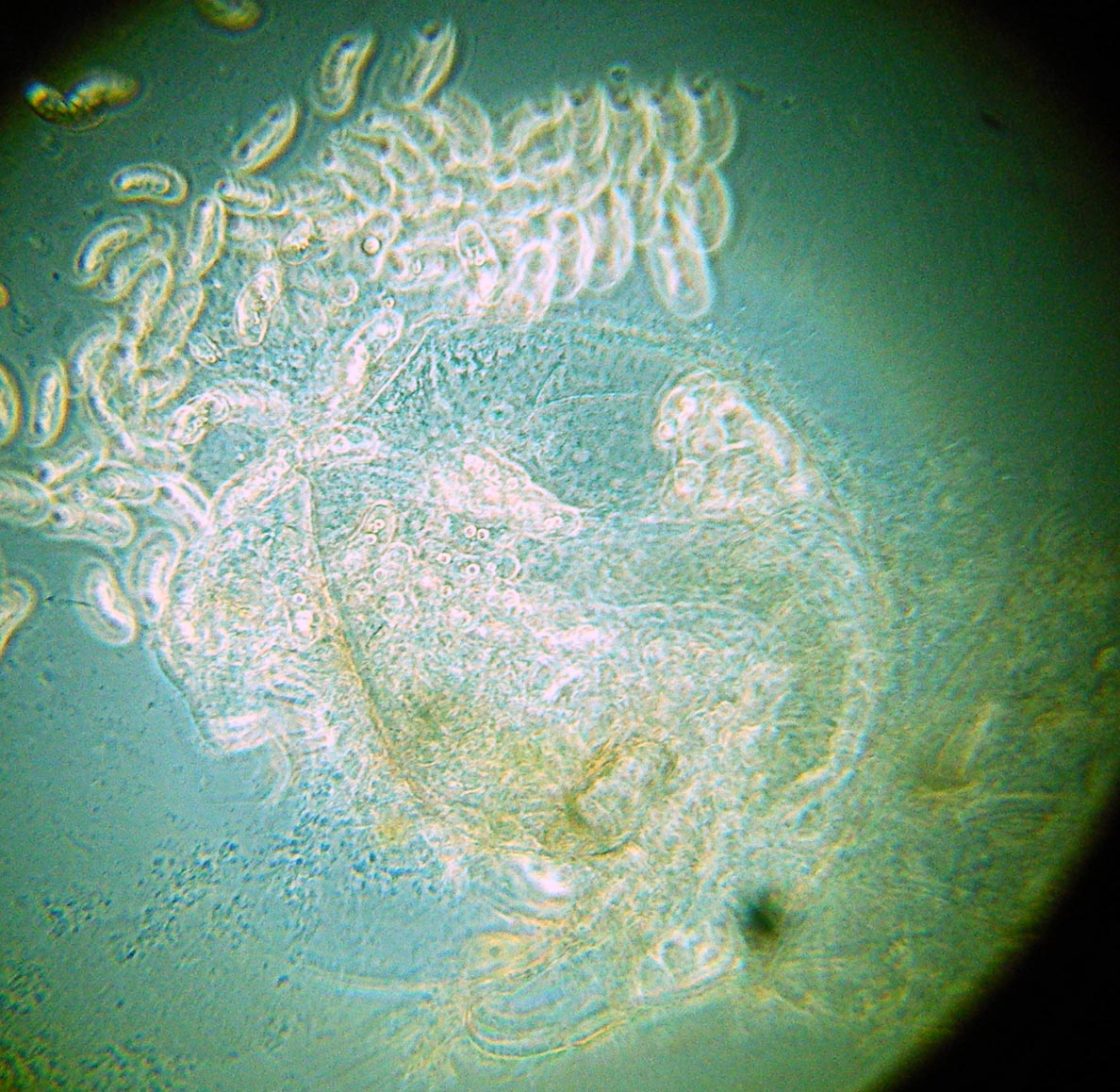 Bosmina longirostris mit ausgetretenen Endoparasiten Coelosporidium cf. chydoricolae
