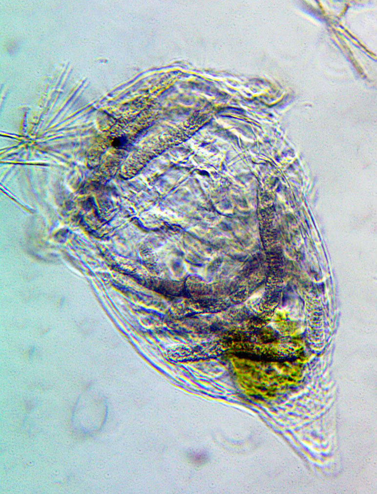 Synchaeta cf. pectinata mit Endoparasit Bertramia asperospora