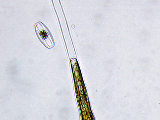 Gomphonema acuminatum
