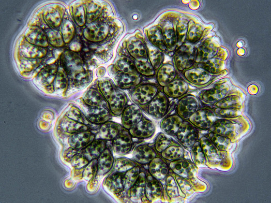 Botryococcus braunii mit Öltröpfchen