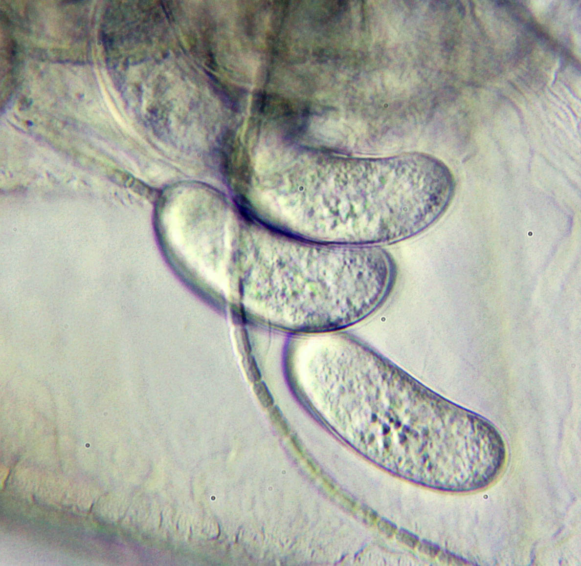 Coelosporidium chydoricola