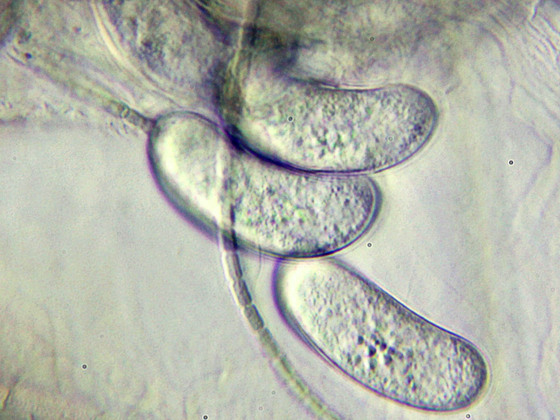 Coelosporidium chydoricola