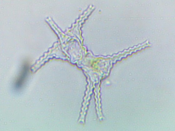 Staurastrum spec, cf. paradoxum