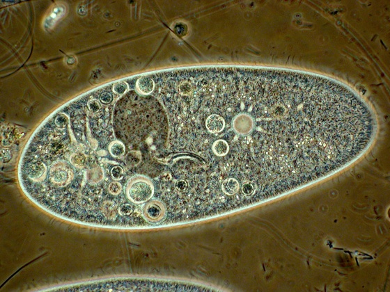 Paramecium caudatum im PK (zu erkennen u.a.; Groß-/Kleinkern, Mundfeld, pulsierende Vakuolen)