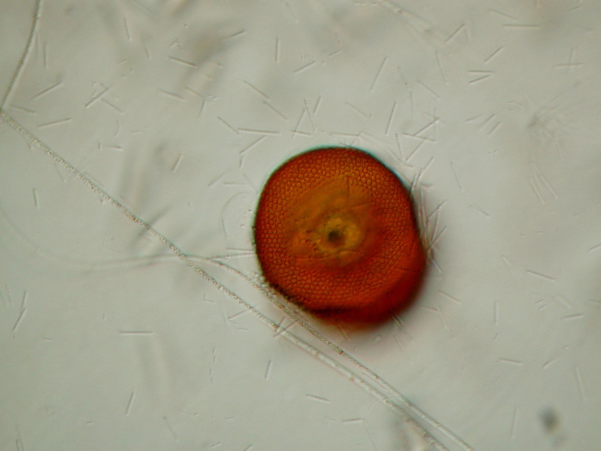 Arcella spec.(Wabenstruktur der Schale), umgeben von stabförmigen Bakterien und fadenförmigen Schwefelbakterien (Beggiatoa spec. ?)