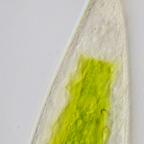 Closterium acerosum (SCHR.) EHR ex RALFS var. elongatum BRÉB.