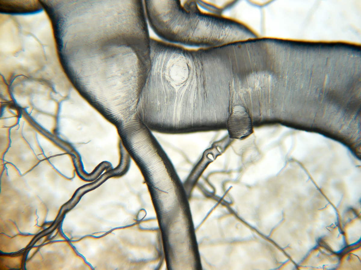 Tracheen diverse Bilder Das deutschsprachige MikroskopieForum