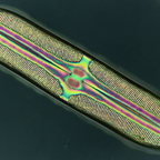 Pinnularia