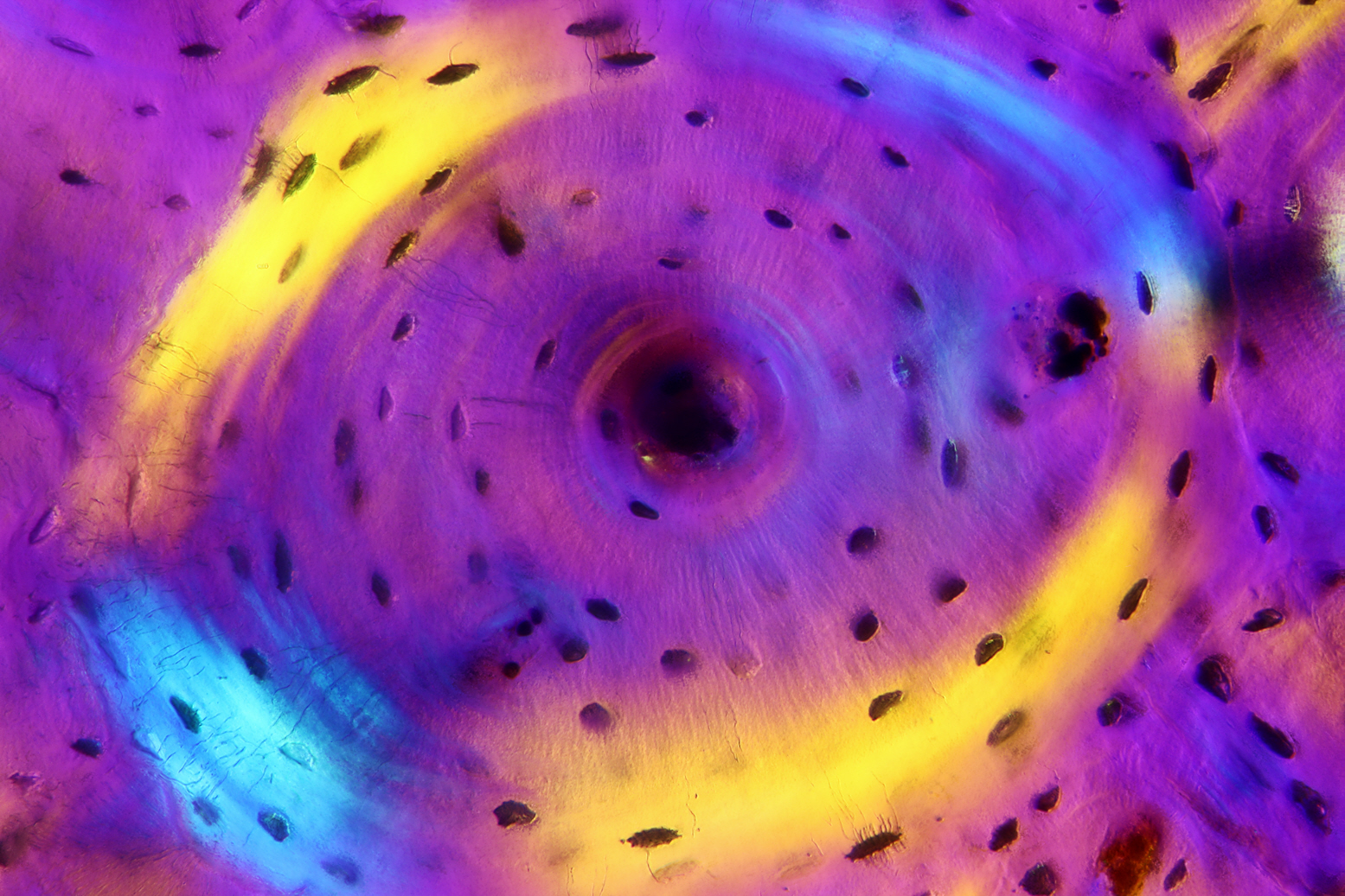 Röhrenknochen Galerie Das deutschsprachige MikroskopieForum